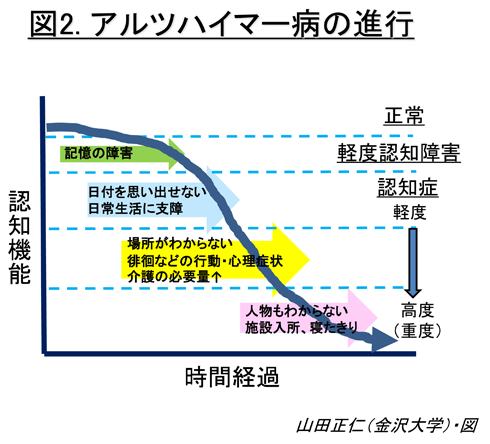 アルツハイマー 型 認知 症 と は