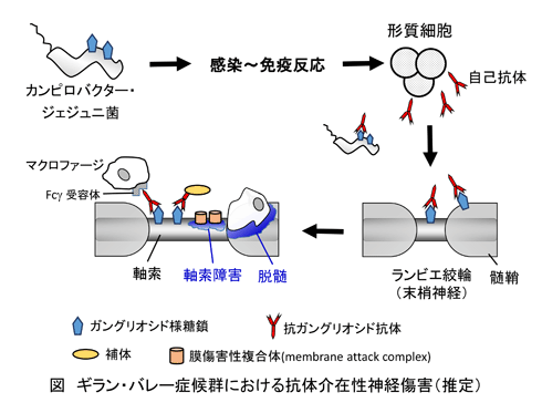 ギラン バレー症候群 疾患 用語編 免疫性ニューロパチー 神経内科の主な病気 日本神経学会